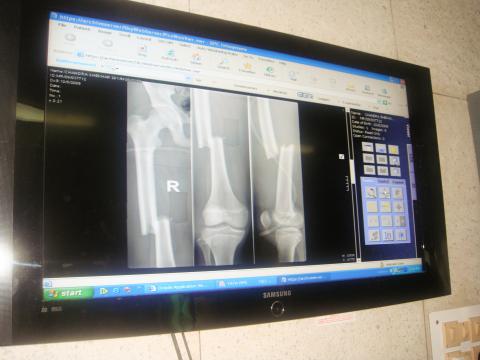 X-Ray